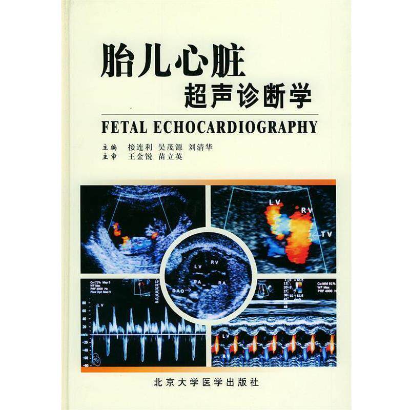 【正版书】 胎儿心脏超声诊断学 接连利,吴茂源,刘清华 主编 北京大学医学出版社
