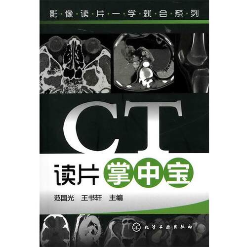 【正版书】 影像读片一学就会系列--CT读片掌中宝 范国光 化学工业出版社