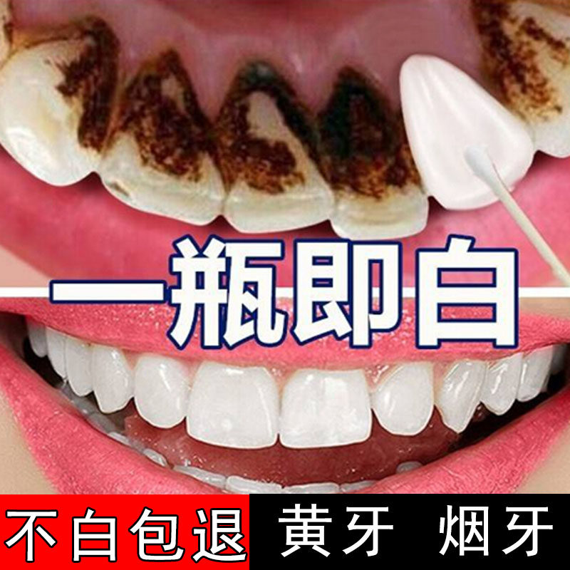 洗牙粉非美白去除牙渍垢膏液口臭男抽烟黑黄牙齿变白洁牙斑净