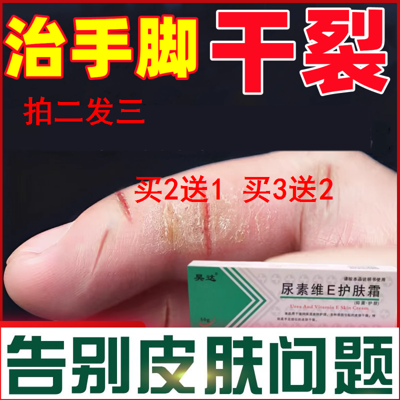 治手裂的药膏防干裂专治手指开裂皲裂脚后跟裂口手脱皮专用修复霜