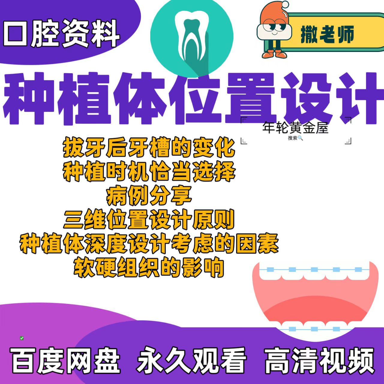 口腔种植课种植体位置设计拔牙后牙槽变化软硬组织影响三维位置