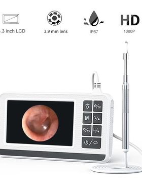 Digital Otoscope with 4.3