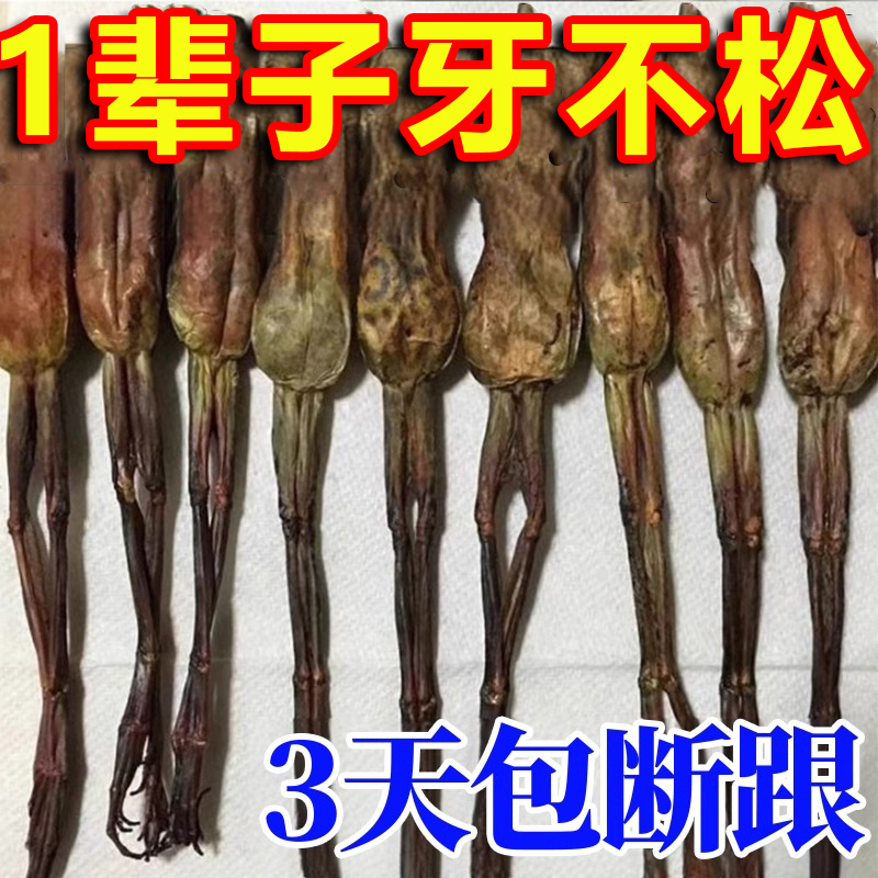 【牙不掉就能救】牙龈退缩牙根外露固齿牙膏修复牙龈肿痛酸软出血