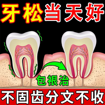 【牙不掉就能救】松动固齿牙膏