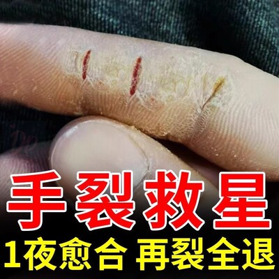 云南本草脚后跟干裂修复愈裂霜龟裂开裂皲裂秋冬护手足裂口马油膏