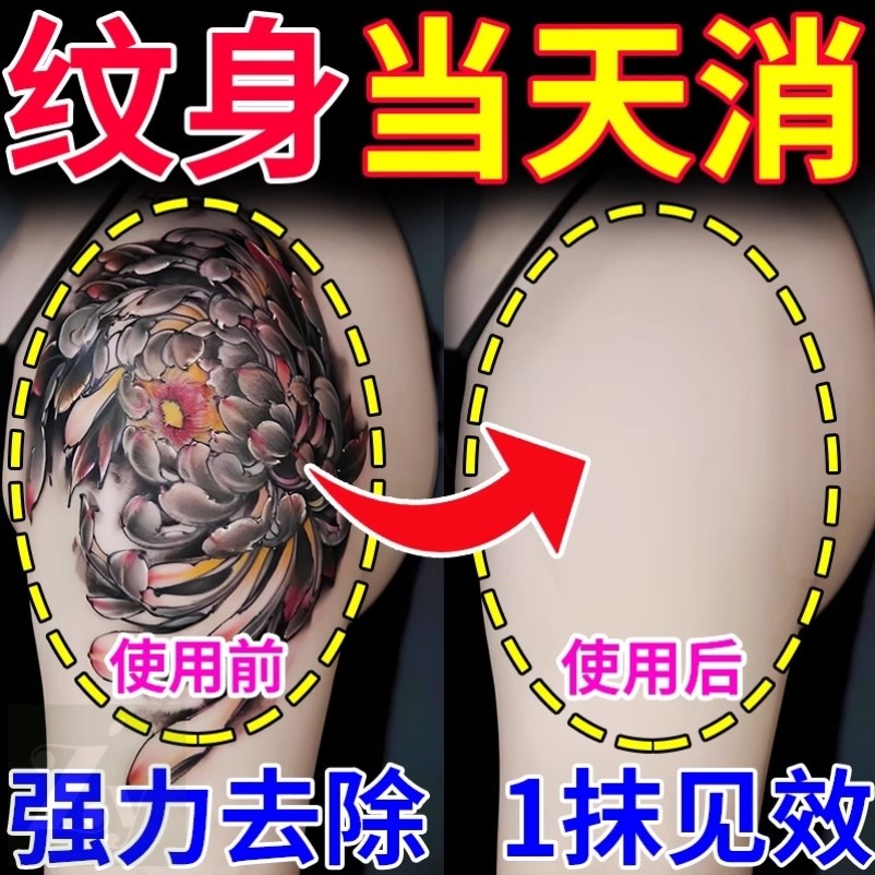 洗纹身神器不留疤痕快速纹身刺青文身褪色剂去除非药水膏无痛通用