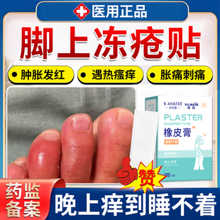 脚趾冻疮贴医用级冻伤贴冻裂胶布脚裂贴干裂手指脚趾红肿瘙痒膏KD
