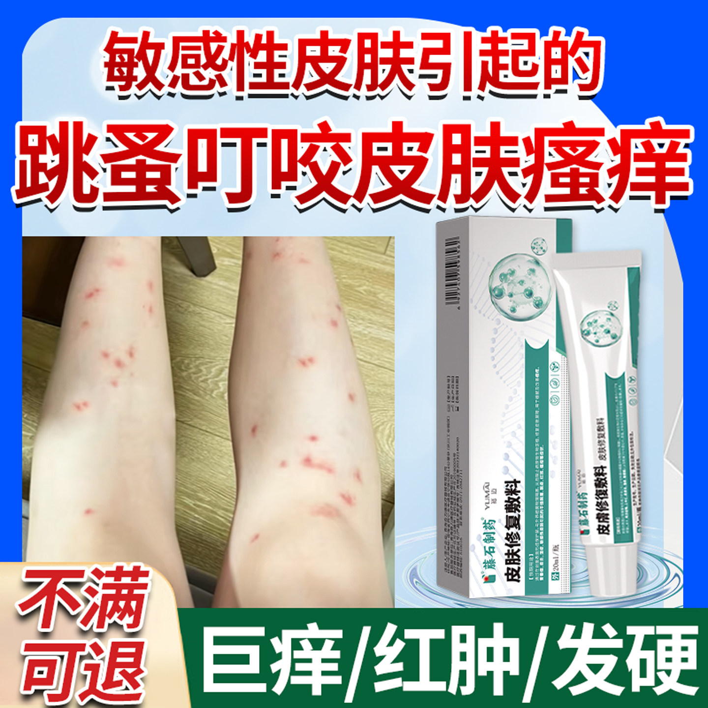 跳蚤咬止痒膏瘙痒红肿专药监备案用被跳蚤咬用什么擦蚊虫叮咬KD