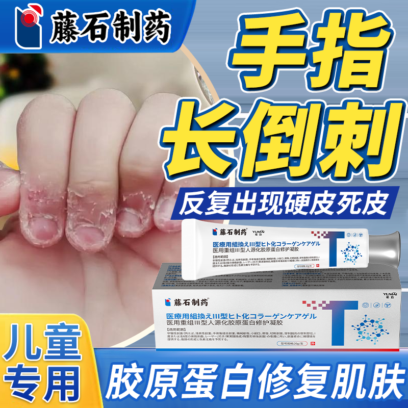 手指长倒刺起皮死皮干裂宝宝儿童甲周疣专用膏药监备案修复神器QY