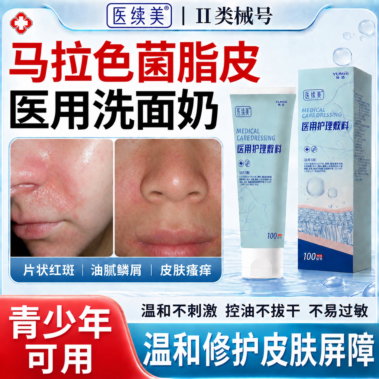医续美马拉色菌洗面奶脂溢性皮炎面部修复护肤医用鼻翼两侧泛红TZ