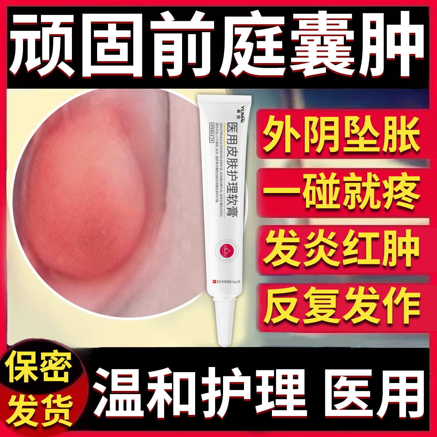 前庭大腺巴氏腺囊肿可搭膏药贴外阴长疙瘩肿痛脓包痘痘火疖子VV
