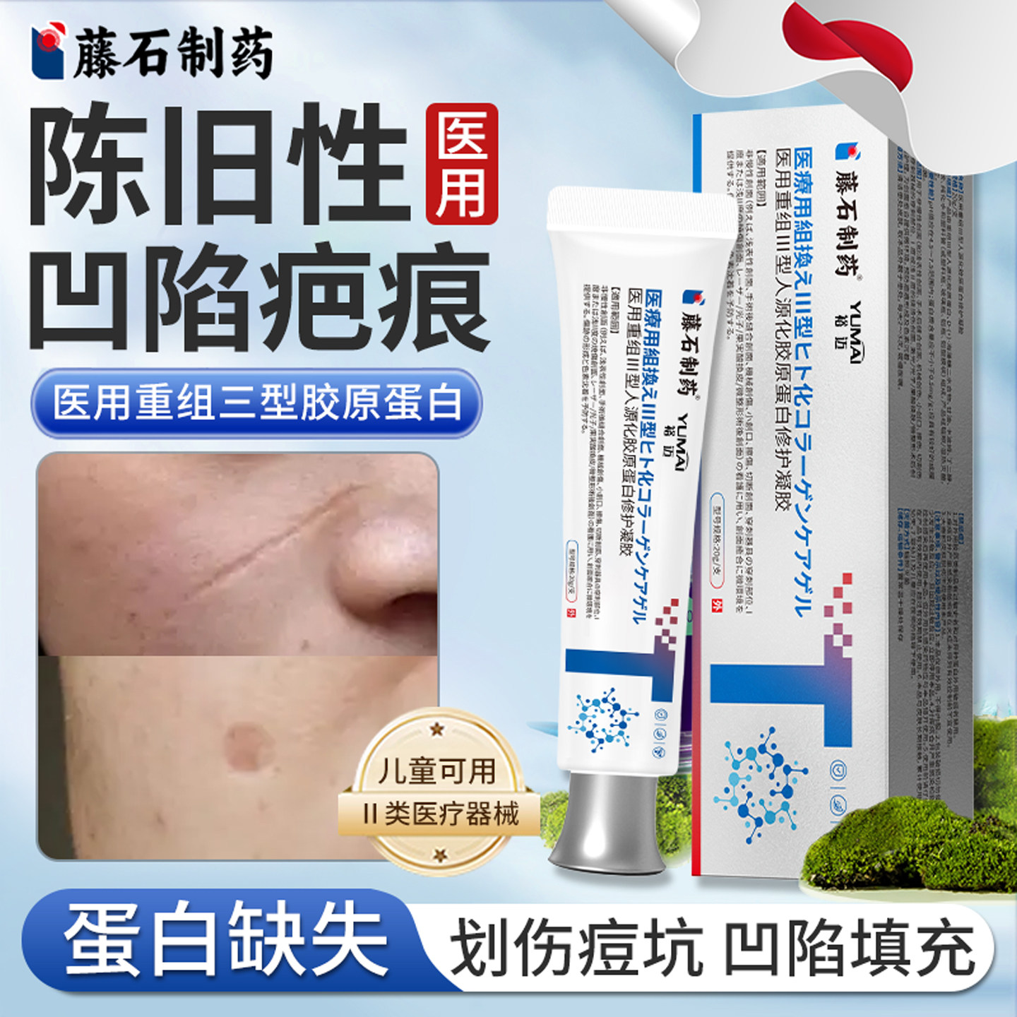 陈旧性凹陷性疤痕修复膏填充生长因子祛疤除疤膏指甲抓伤去疤膏KD,医疗器械,祛疤产品,淘宝优惠券,粉丝福利购,淘宝优惠卷