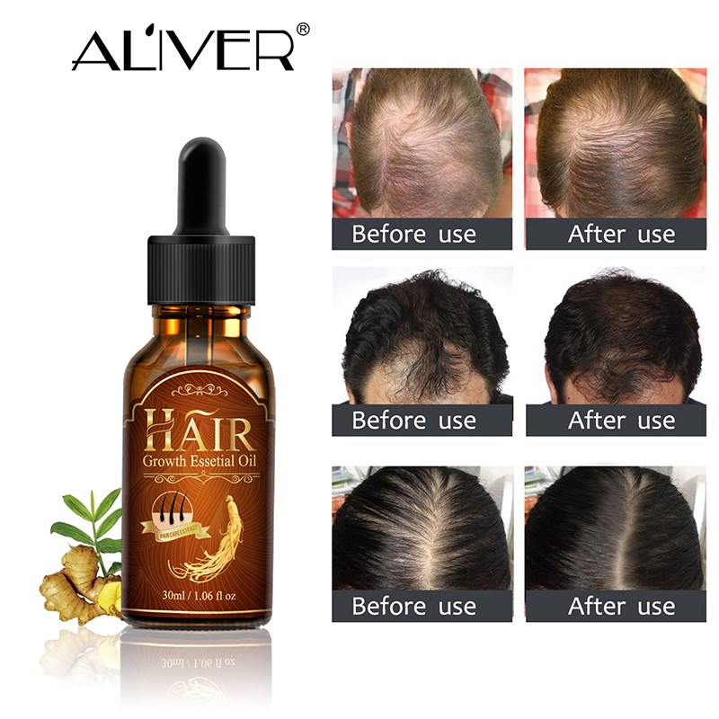 Hair Growth Ginger Oil Tonic Toppies Shampoo anti Hair Loss