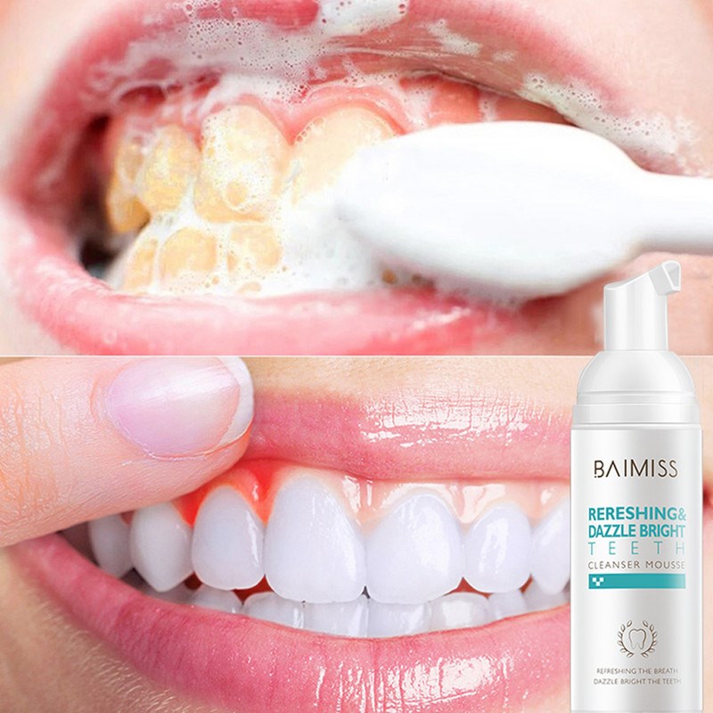 洁牙慕斯泡沫 Shining Tooth Cleaning Mousse Teeth Whitening