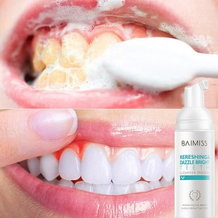 洁牙慕斯泡沫 Shining Tooth Cleaning Mousse Teeth Whitening