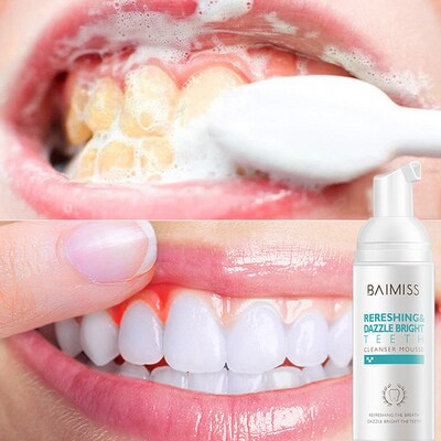 洁牙慕斯泡沫 Shining Tooth Cleaning Mousse Teeth Whitening