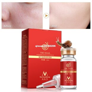 Snail serum  pureplant extract hyaluronic acid skin repa