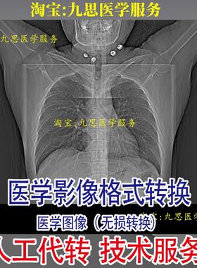 Dicom dcm医学影像CT图片下载 人工转换视频格式AVI MP4 JPG BMP