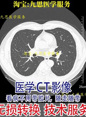 提供医学dicom原文件转换格式 dicom格式转换图片 PDF  视频格式