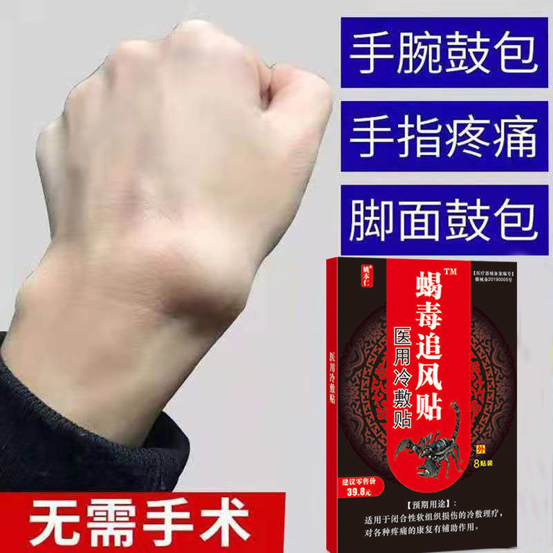 【手指手腕】腱鞘炎贴腱鞘炎大拇指关节疼痛腕部鼓包
