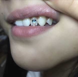 diy专用粘牙钻材料饰品獠牙蝴蝶海星猫爪不伤牙持久保证辣妹闪钻