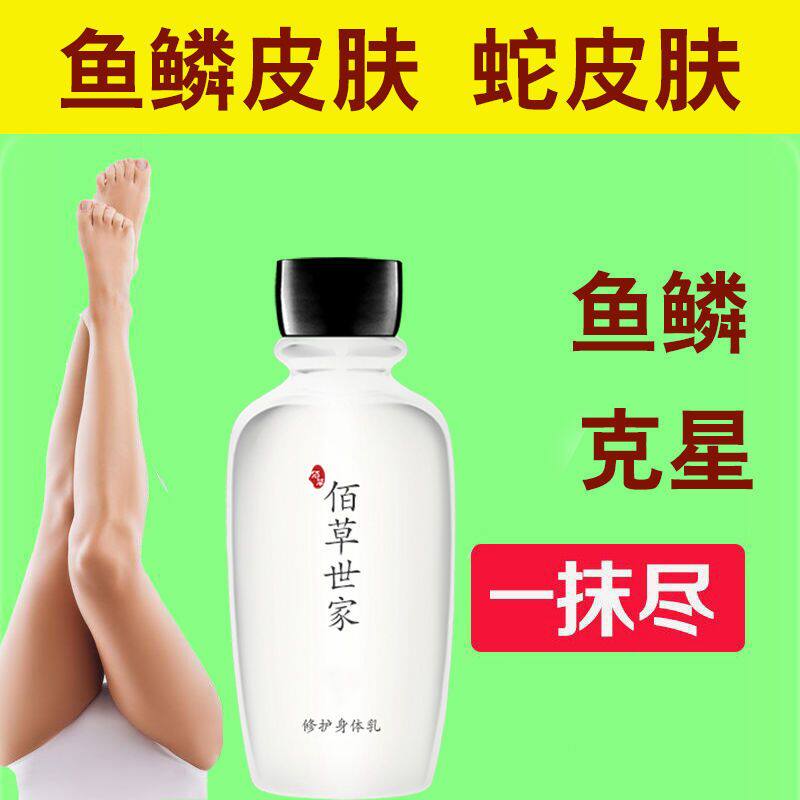 佰草世家【去蛇皮肤霜】祛鱼鳞鸡皮疙瘩毛周角化干燥起皮身体乳