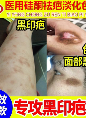 祛疤膏去除淡化淡疤印黑印黑色素沉淀沉着修复去疤痕除疤硅酮凝胶