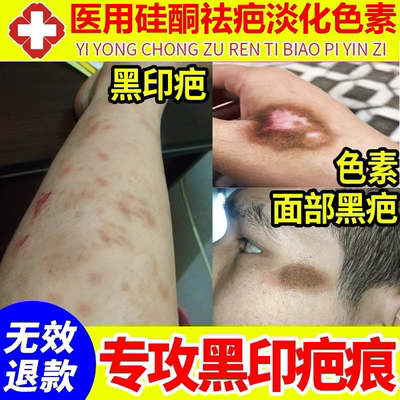 祛疤膏去除淡化淡疤印修复去疤