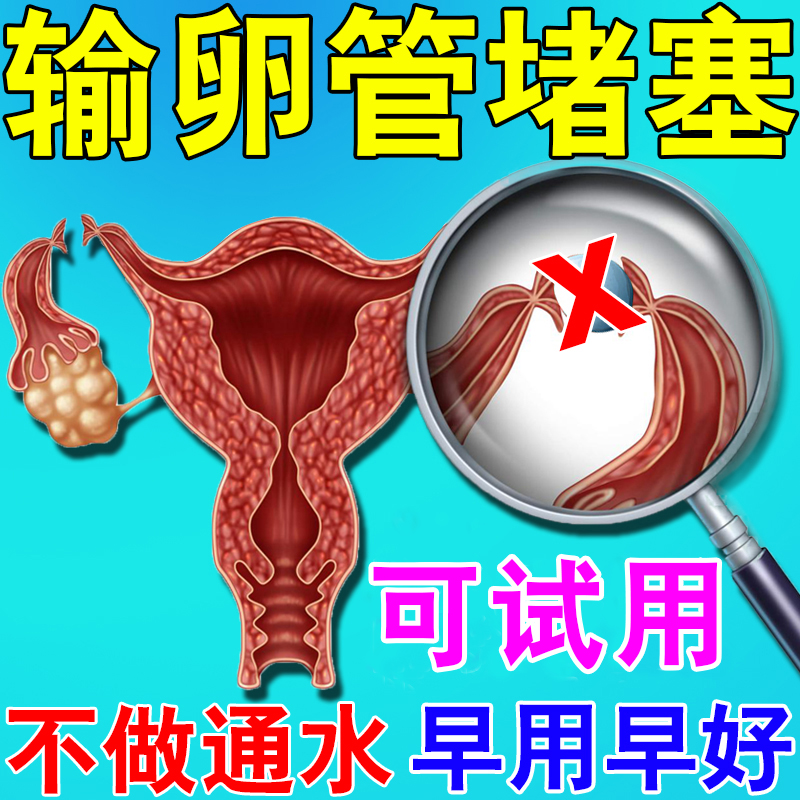 输卵管堵塞疏通的药贴治疗盆腔积水积液热敷包多囊卵巢伞端粘连Z