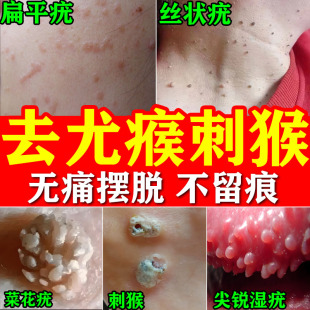 疣瘊肉粒一抹无忧【清尤膏】抑菌液去肉刺瘊子神器丝状疣腋下疣灵