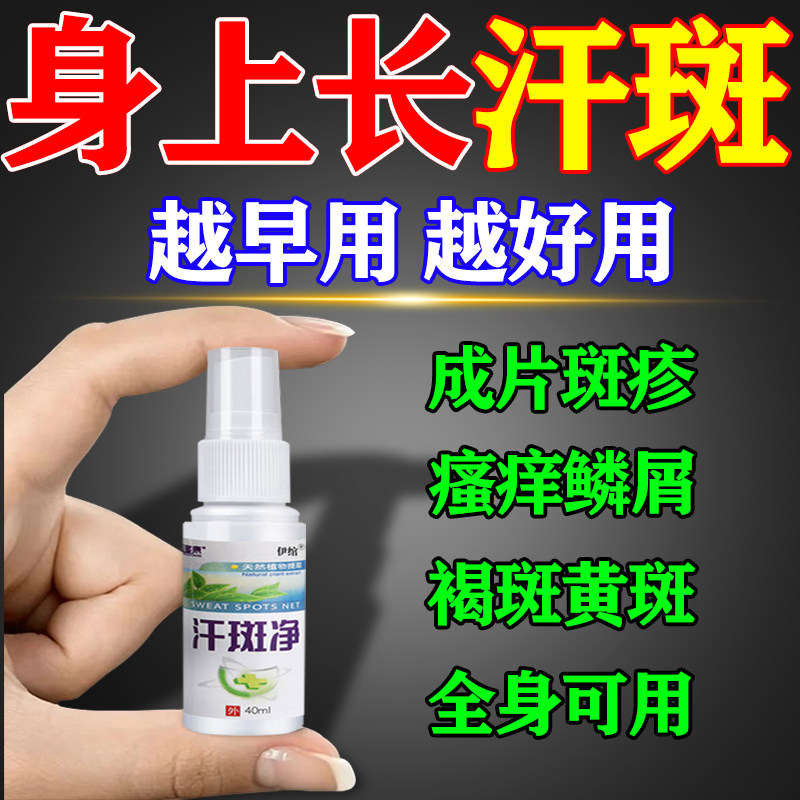汗斑净花斑用专特效治汗斑花斑藓皮肤去腋下白斑喷剂止痒抑菌膏药