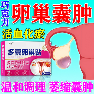 卵巢囊肿的中膏药贴附件区热敷巧克力多囊卵巢综合征调理子宫肌瘤