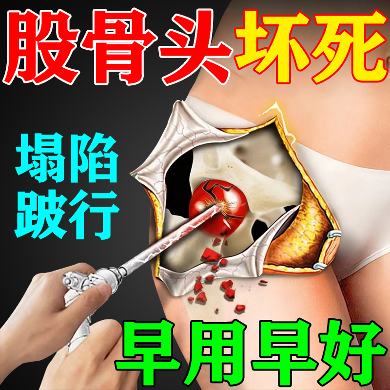 早用早好】股骨头坏死用专膏药贴