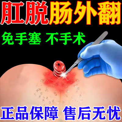 脱肛特痛用专效膏药肛门外坠胀