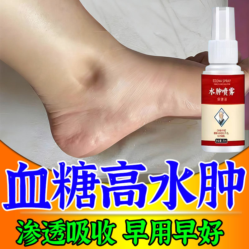 水肿消肿用专药去老人下肢水肿