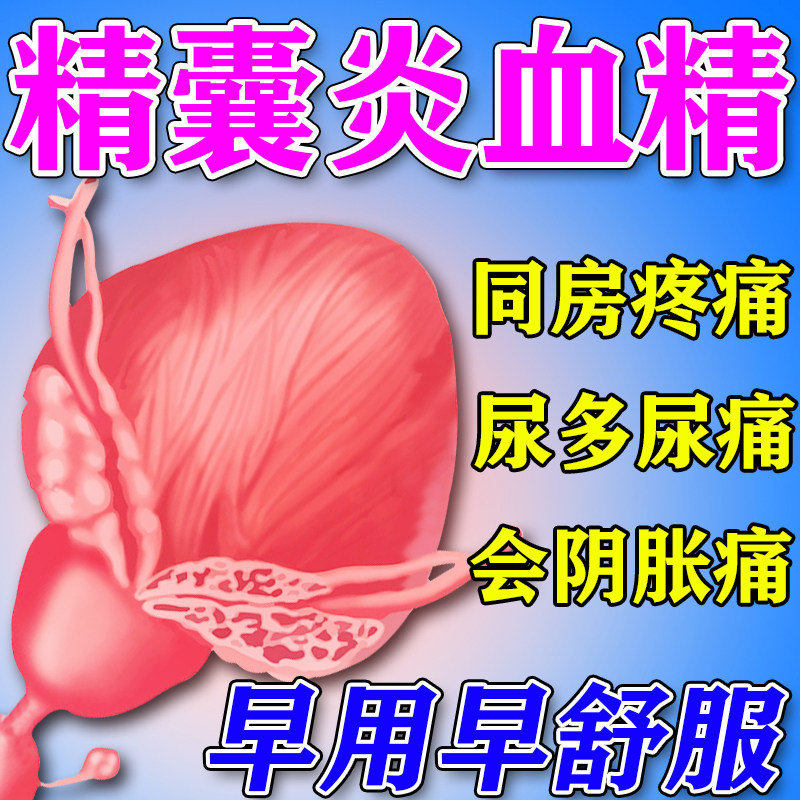 精囊炎血精症治疗睾丸炎症精子发黄效特药尿多尿痛前列腺保健贴