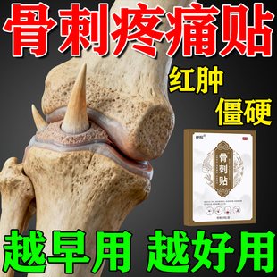 骨刺骨质增生膏贴膏专用药足跟骨刺痛专用膏骨刺祛痛膏全身通用