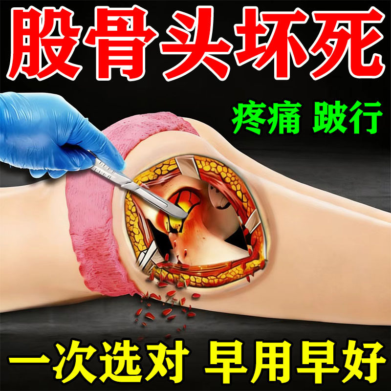 一次选对】股骨头坏死用专膏药贴