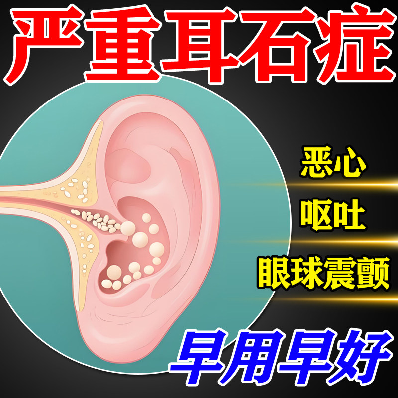 【早用早好】耳石症眩晕效特药