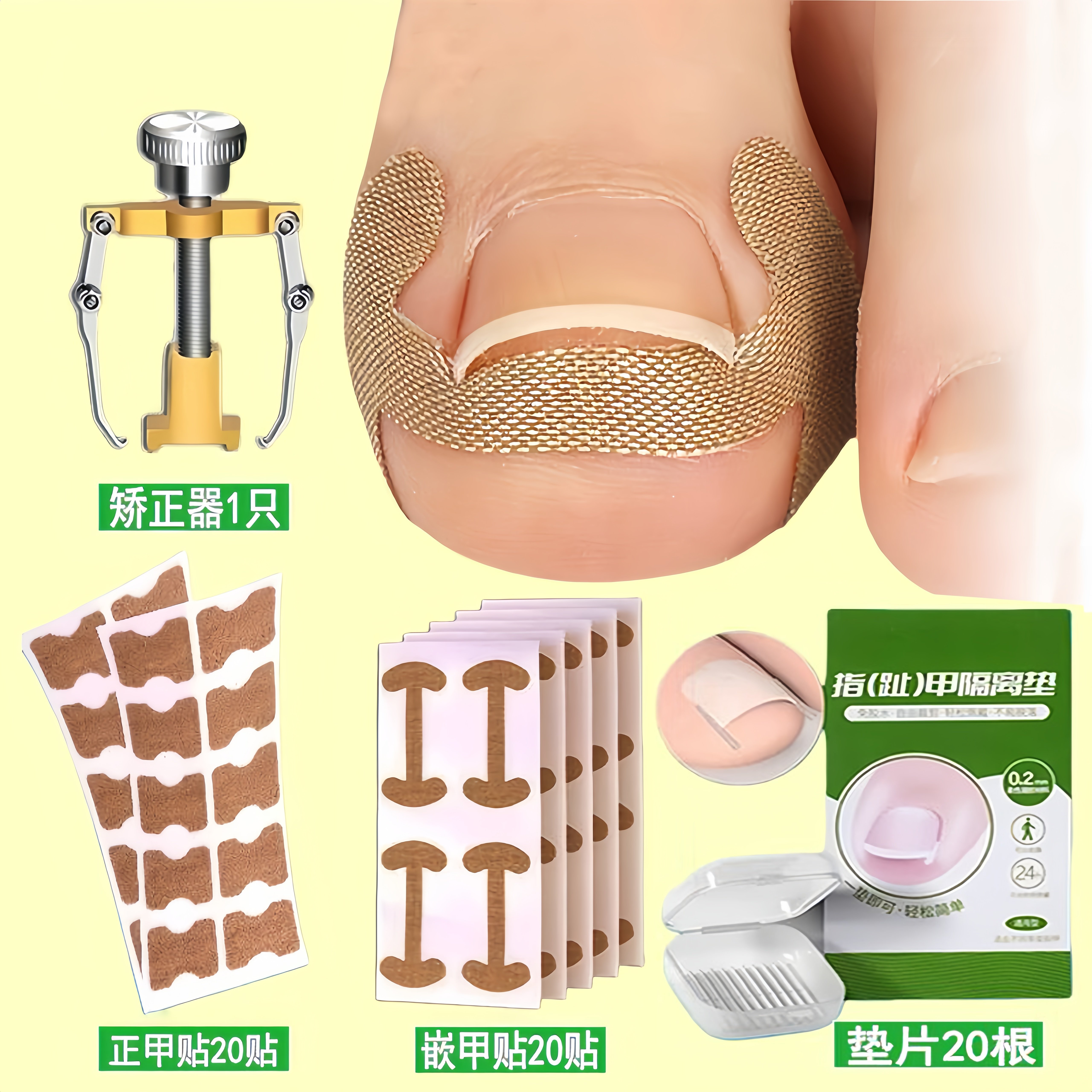 甲沟矫正器嵌甲贴片神器防止指甲长肉里青少年专用正甲垫片工具炎,家庭/个人清洁工具,美甲/修甲套装,淘宝优惠券,粉丝福利购,淘宝优惠卷