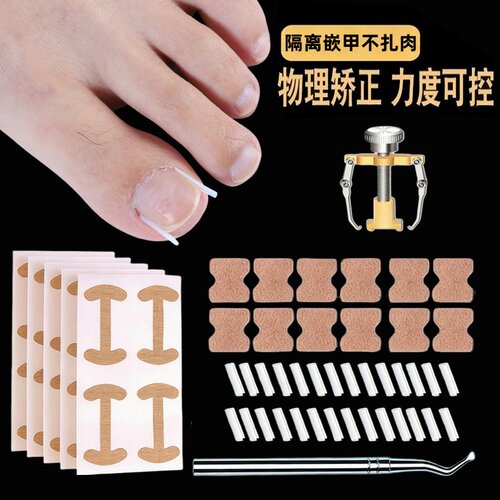 甲沟矫正器嵌甲贴片神器防止脚趾甲往肉里长专用隔离填充垫正甲贴