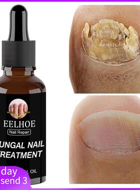 30ml Fungal Nail Repair Essence Feet CareTreatment Foot Toe