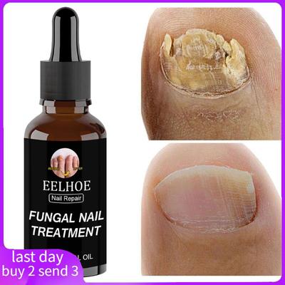 30mlFungaNaiReprEctC