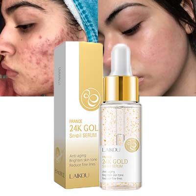 Snail Repairing Serum Anti-Acne Essence Scars蜗牛面部精华液