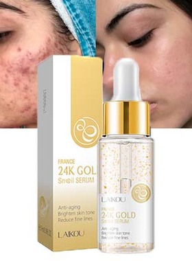 Snail Repairing Serum Anti-Acne Essence Scars蜗牛面部精华液