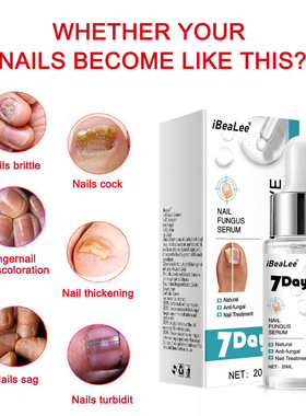 iBeaLee Repair Grey Nail Fungus Treatments Essence Foot Care