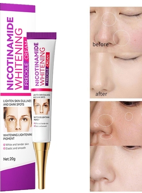 Nicotinamide Whitening Dark Spots Cream Freckle Removal Brig
