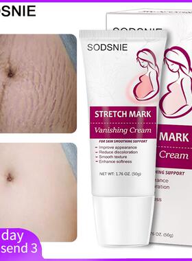 StretchMarkVanisgCm