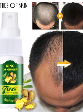 Hair Growth Product Anti Hair Loss Baldness Spray生姜育发液