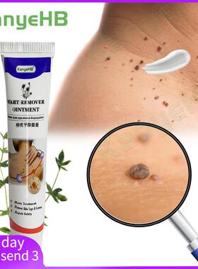 2Warts Remover Ointment Wart Treatment Cream Skin Tag Remove